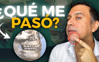 🤫 ¿Por qué DESAPARECÍ estos 2 MESES? | ¿Qué es una Cirugía Ortognática? (Recuperación)